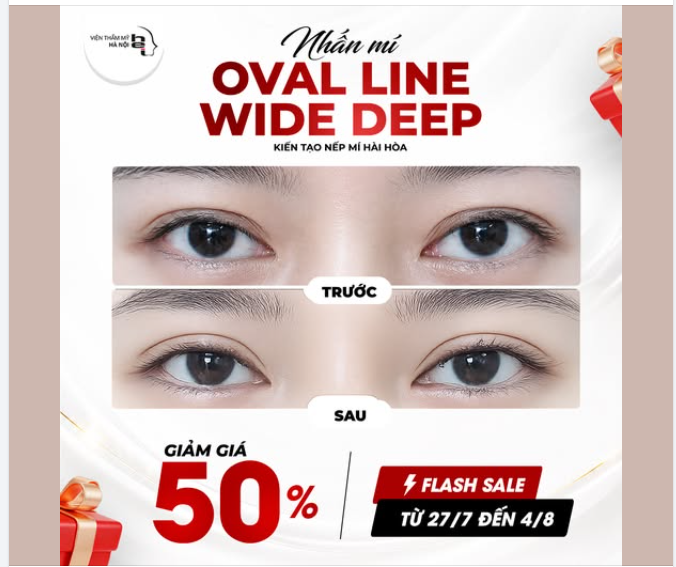 FLASH SALE - NHẤN MÍ OVAL LINE WIDE DEEP