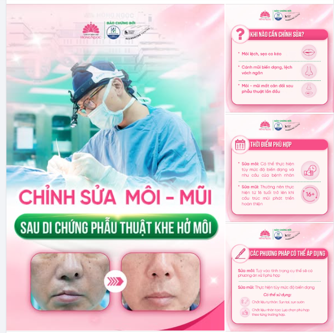 CHỈNH SỬA MÔI - MŨI SAU DI CHỨNG PT KHE HỞ MÔI : HOÀN THIỆN DIỆN MẠO, TỰ TIN HƠN MỖI NGÀY