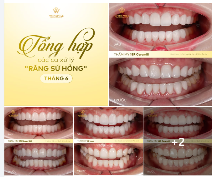 THÁNG 6 TẠI WIN SMILE: KHI NIỀM TIN ĐƯỢC CHỮA LÀNH, KHÍ CHẤT SẼ LÊN TIẾNG