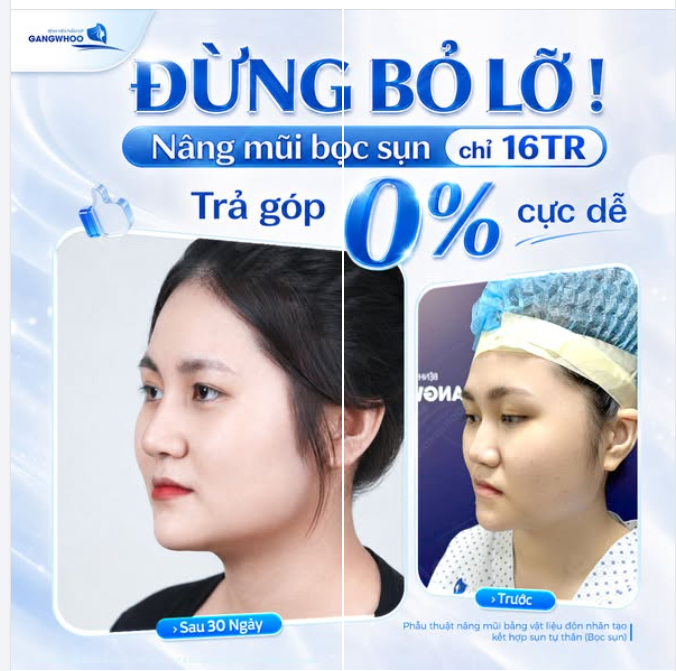 CƠ HỘI LỚN ĐỪNG BỎ LỠ
