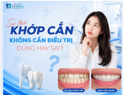 SAI LỆCH KHỚP CẮN KHÔNG CẦN XỬ LÝ? ĐÚNG HAY SAI?