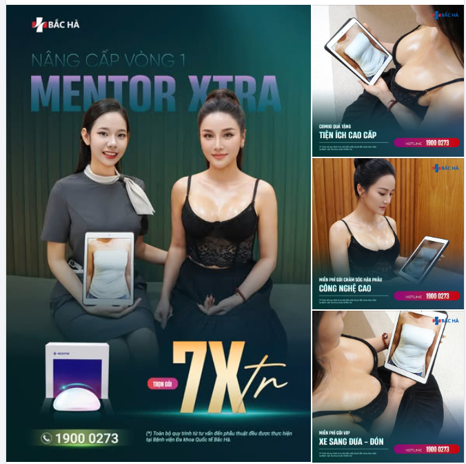 NÂNG NGỰC MENTOR XTRA CHỈ TỪ 7XTR TRỌN GÓI