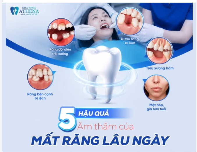 5 HẬU QUẢ ÂM THẦM CỦA VIỆC MẤT RĂNG LÂU NGÀY – ĐỪNG CHỦ QUAN!