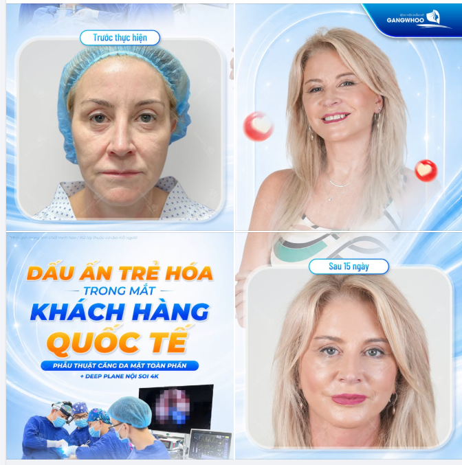 DẤU ẤN TRẺ HÓA TRONG MẮT KHÁCH HÀNG QUỐC TẾ