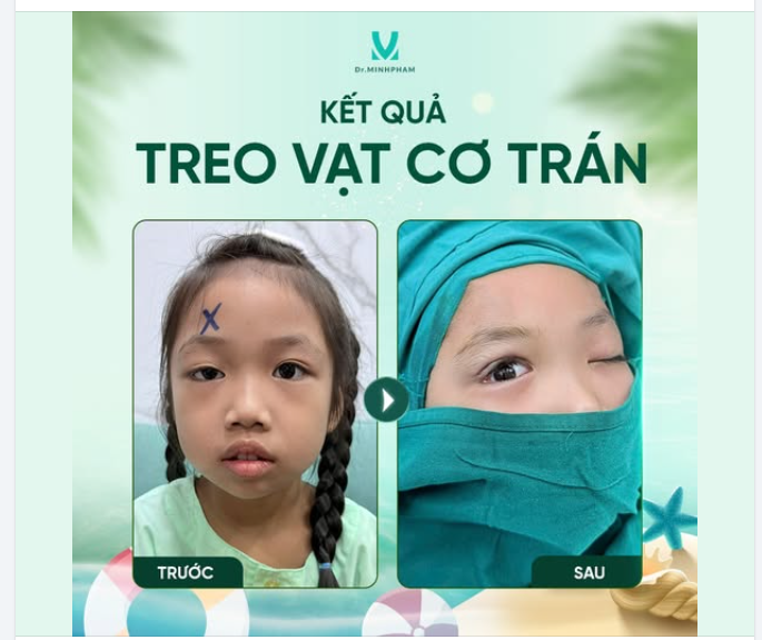 MỞ RỘNG ÁNH NHÌN – THAY ĐỔI TƯƠNG LAI