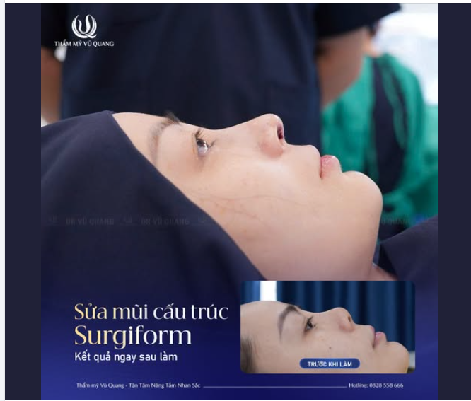 GIẢI CỨU THÀNH CÔNG CA MŨI CO RÚT PHỨC TẠP SAU 7 NĂM