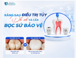 VÌ SAO RĂNG SAU KHI LÀM SẠCH TỦY DỄ NỨT VỠ VÀ CẦN BỌC BẢO VỆ?