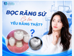 BỌC RĂNG SỨ CÓ LÀM YẾU RĂNG THẬT KHÔNG?