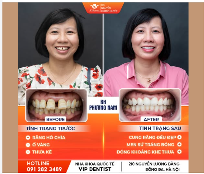 THAY RĂNG ĐỔI VẬN – TỰ TIN CHẠM TỚI THÀNH CÔNG!