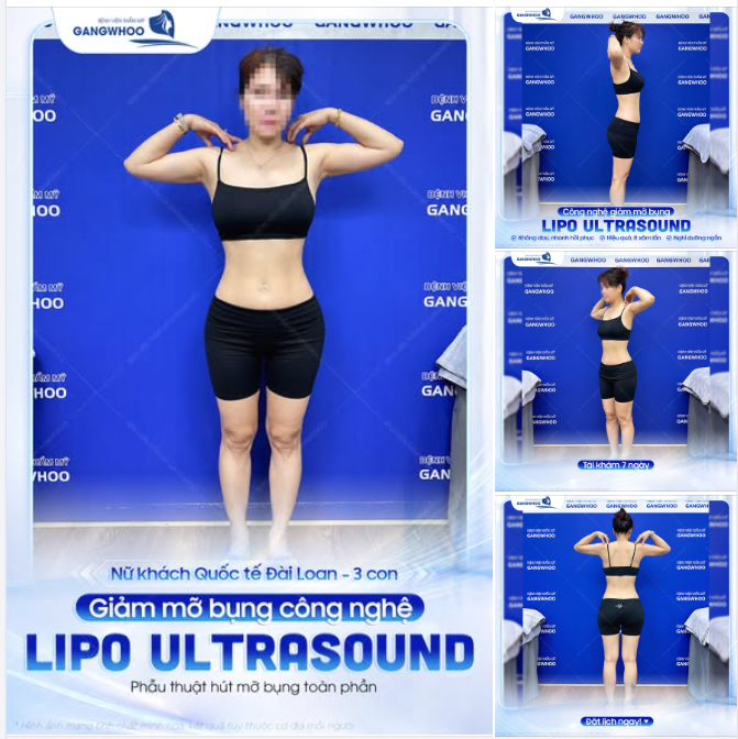 HÀNH TRÌNH TÌM LẠI VÒNG EO THON GỌN CỦA NGƯỜI MẸ 3 CON