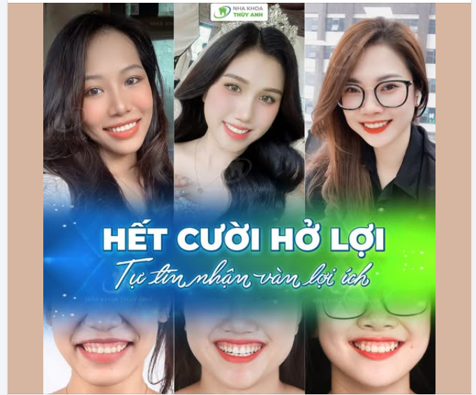 XÓA TAN CƯỜI HỞ LỢI – ĐẸP KHÔNG CHỈ LÀ THẨM MỸ, MÀ CÒN LÀ SỰ TỰ TIN