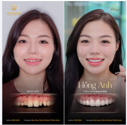 Có những khuyết điểm nhỏ nhưng lại vô tình che mờ đi cả một tổng thể thanh tú.