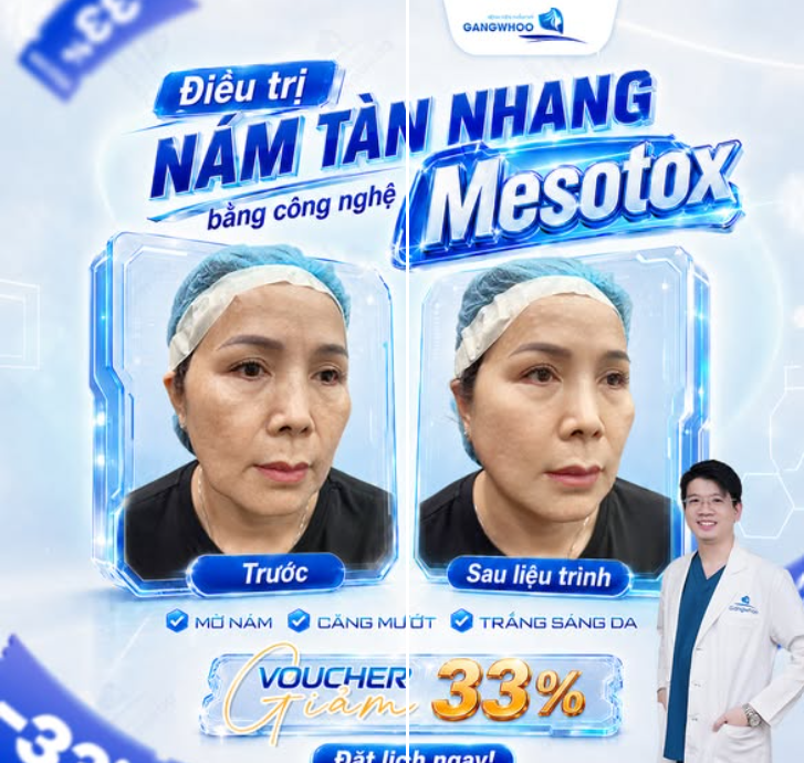 MESOTOX – CHĂM SÓC LÀN DA NÁM, TÀN NHANG THEO LIỆU TRÌNH CÁ NHÂN HÓA