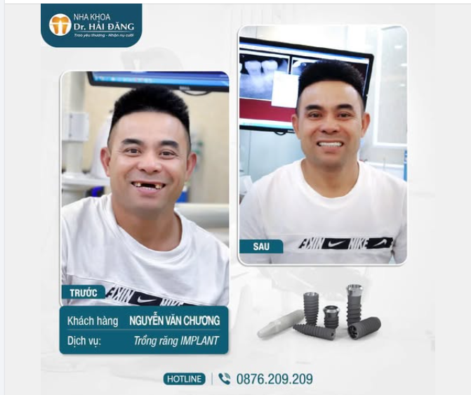 NỤ CƯỜI THAY ĐỔI – CUỘC SỐNG TỰ TIN HƠN