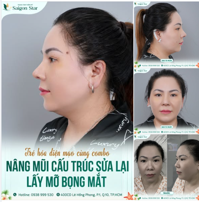 THAY ĐỔI NHỎ Ở DÁNG MŨI, "LỘT XÁC" CẢ THẦN THÁI!
