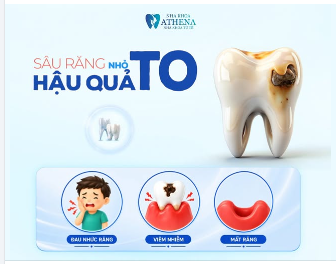 VẾT ĐỔM NHỎ TRÊN RĂNG – HẬU QUẢ LỚN CHO VÍ TIỀN!