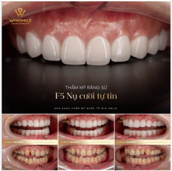 Mỗi sự thay đổi tại Win Smile là hành trình đánh thức sự tự tin vốn có của mỗi khách hàng.