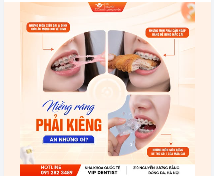 KHI NIỀNG RĂNG, BẠN CẦN "KHOANH VÙNG" NHỮNG MÓN ĂN NÀO?