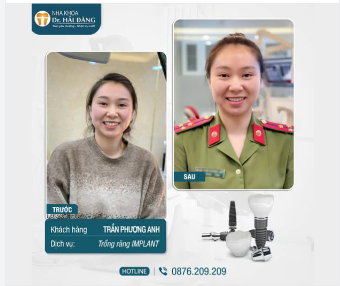 THAY ĐỔI NỤ CƯỜI – TỰ TIN HƠN MỖI NGÀY