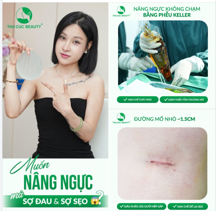 MUỐN NÂNG NGỰC NHƯNG SỢ ĐAU, SỢ ĐỂ LẠI SẸO?