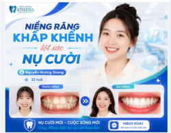RĂNG KHẤP KHỂNH - "LỘT XÁC" NỤ CƯỜI HOÀN HẢO!