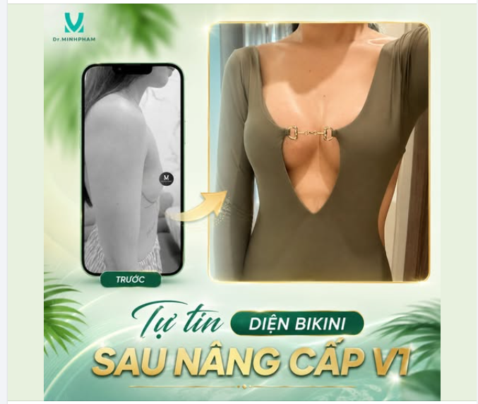 Trước đây, vòng 1 teo lép, thiếu độ nhô khiến khách hàng luôn e ngại khi diện bikini hay những trang phục ôm sát.