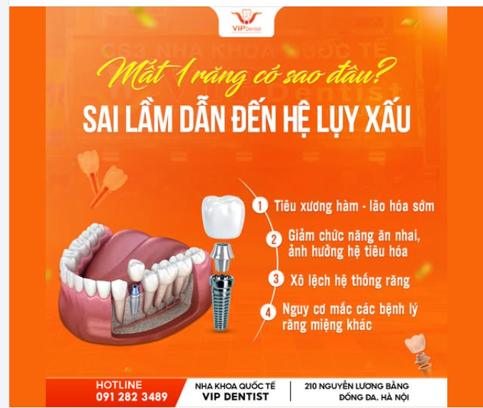 "MẤT 1 RĂNG CÓ SAO ĐÂU?" – SAI LẦM DẪN ĐẾN HỆ LỤY XẤU!