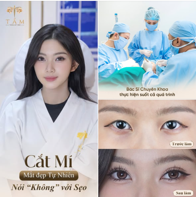 Tự ti rất lâu vì bị chê "mắt híp", Q.A đã chọn cắt mí không sẹo tại Tấm để thay đổi đôi mắt của mình.