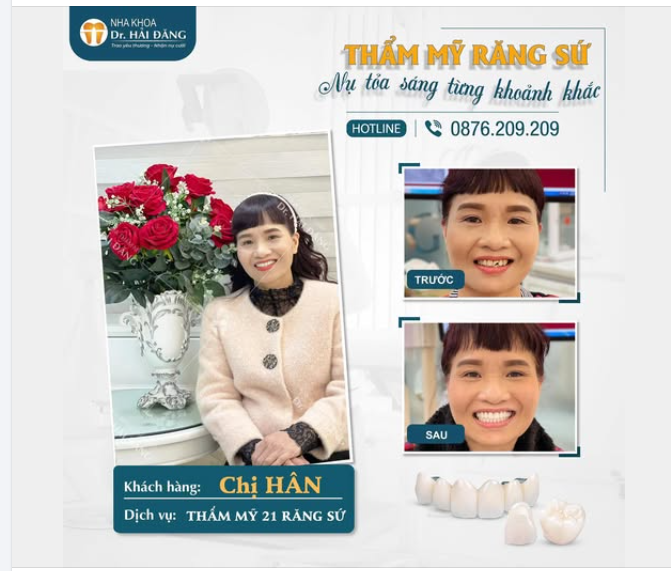 LỘT XÁC NỤ CƯỜI – TỰ TIN TỎA SÁNG MỖI NGÀY