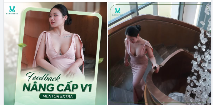 Nâng cấp V1 không đơn thuần là thay đổi vóc dáng, mà còn là hành trình giúp bạn cảm nhận trọn vẹn vẻ đẹp nữ tính.
