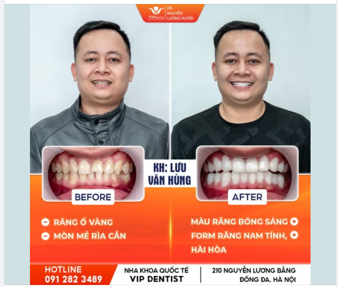 NỤ CƯỜI ĐẲNG CẤP, TỰ TIN BỨT PHÁ!