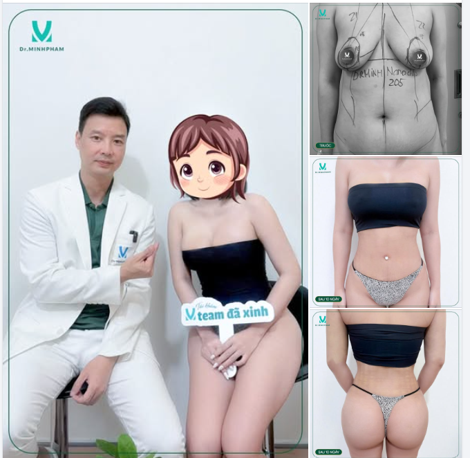 Vòng 1 căng tròn, cân đối, lên form mềm mại và tự nhiên.