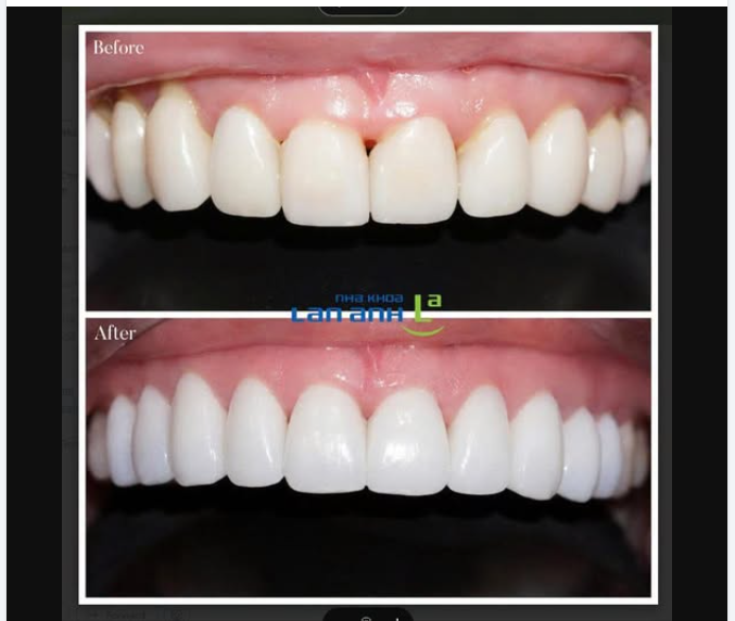 SỨ PRIME CÓ GÌ KHÁC BIỆT?
