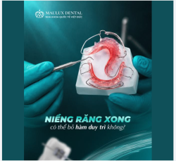 VẬT NHỎ HƠN BÀN TAY NHƯNG VAI TRÒ KHÔNG HỀ NHỎ