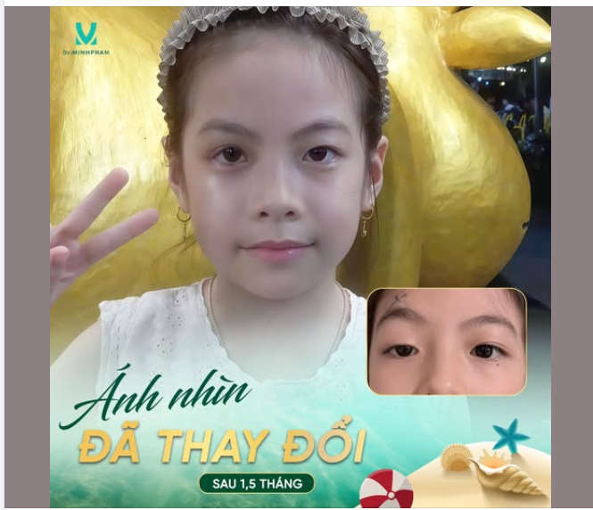 1,5 THÁNG – ÁNH NHÌN ĐÃ THAY ĐỔI