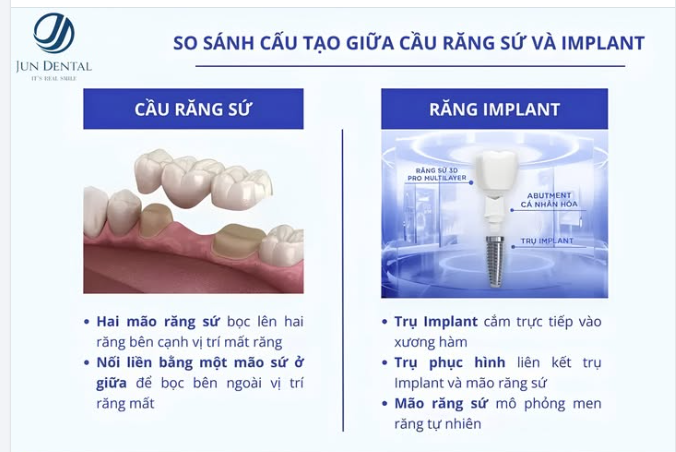 Mất răng không chỉ ảnh hưởng đến thẩm mỹ mà còn tác động lớn đến khả năng ăn nhai và sức khỏe răng miệng.