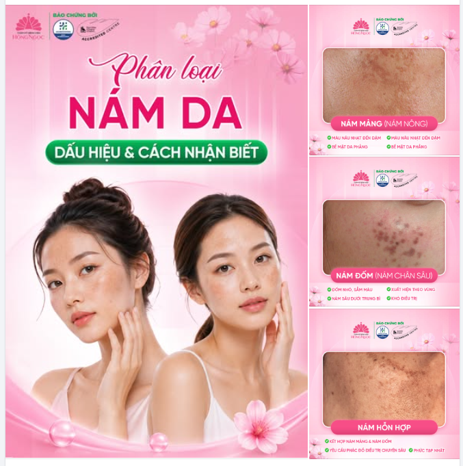 PHÂN LOẠI NÁM DA: NHẬN BIẾT ĐÚNG ĐỂ ĐIỀU TRỊ ĐÚNG