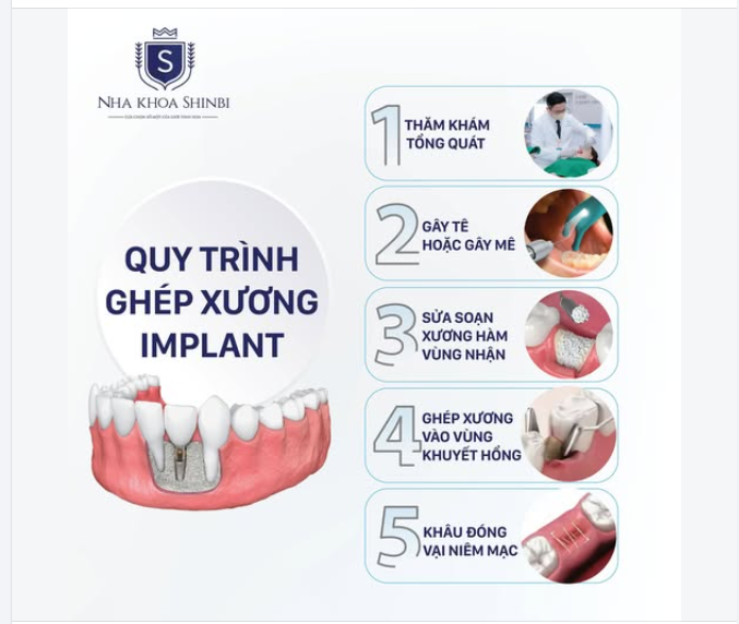 Xương hàm tiêu nhiều — vẫn còn cơ hội. Đừng bỏ cuộc chỉ vì bị nói "không làm được".