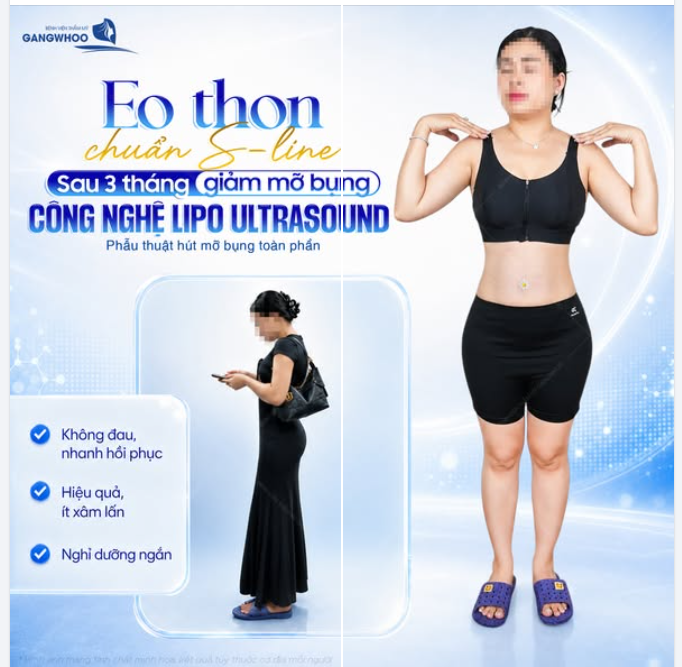 EO THON CHUẨN S-LINE