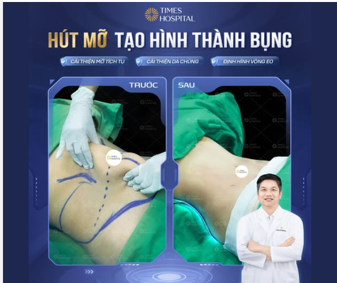 KIẾN TẠO "ĐƯỜNG CONG" VÒNG EO CÙNG TIMES HOSPITAL
