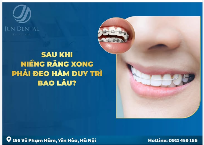 SAU KHI NIỀNG RĂNG XONG PHẢI ĐEO HÀM DUY TRÌ BAO LÂU?