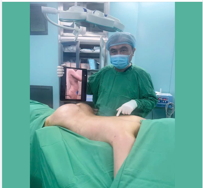 Kiến tạo vóc dáng siêu mẫu cho bạn gái SG