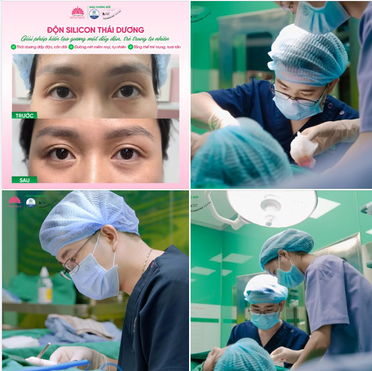 THÁI DƯƠNG HÓP - "ĐIỂM TRỪ" KHIẾN GƯƠNG MẶT GIÀ HƠN CẢ CHỤC TUỔI