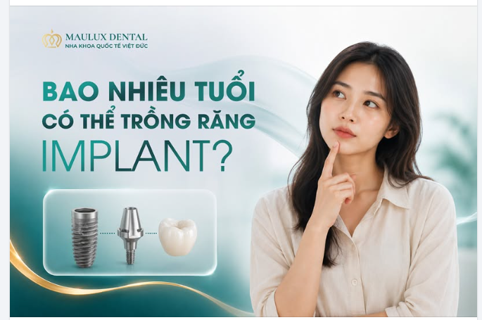 BAO NHIÊU TUỔI CÓ THỂ TRỒNG RĂNG IMPLANT?