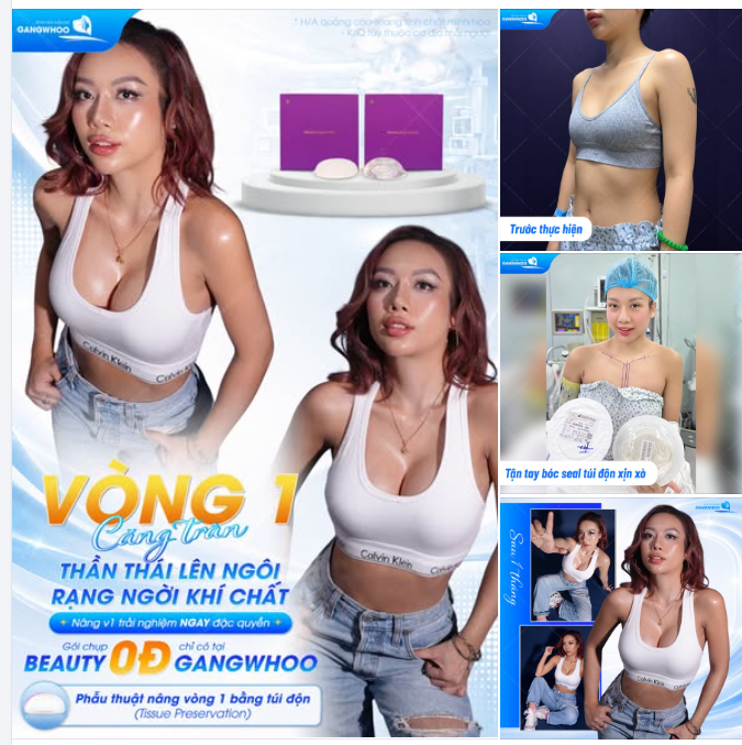 KIẾN TẠO VÒNG 1 CĂNG TRÀN – NÂNG TẦM NHAN SẮC