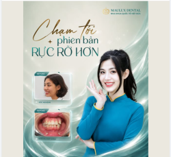 NGHỀ CẦN NỤ CƯỜI. CHỊ LẠI SỢ CƯỜI