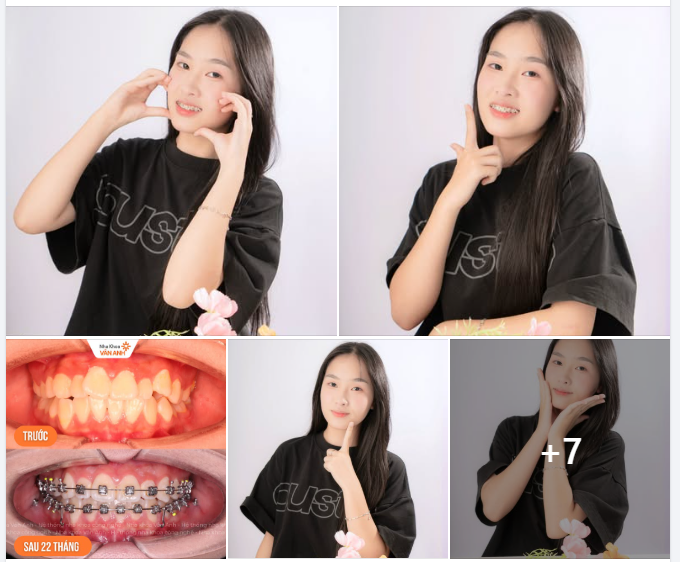 Có những hành trình không cần chờ đến đích mới đáng được lưu giữ