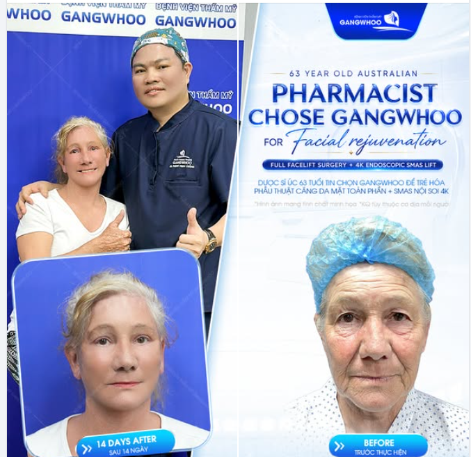 DƯỢC SĨ ÚC 63 TUỔI TIN CHỌN GANGWHOO ĐỂ TRẺ HÓA