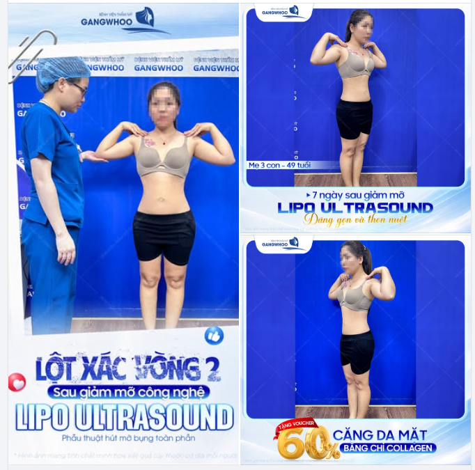 VÒNG 2 THON GỌN - HÀNH TRÌNH TÌM LẠI SỰ TỰ TIN CỦA MẸ 3 CON