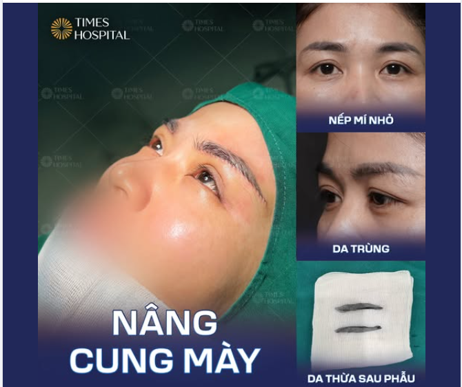CHẠM NHẸ CUNG MÀY – LẤY LẠI NÉT XUÂN